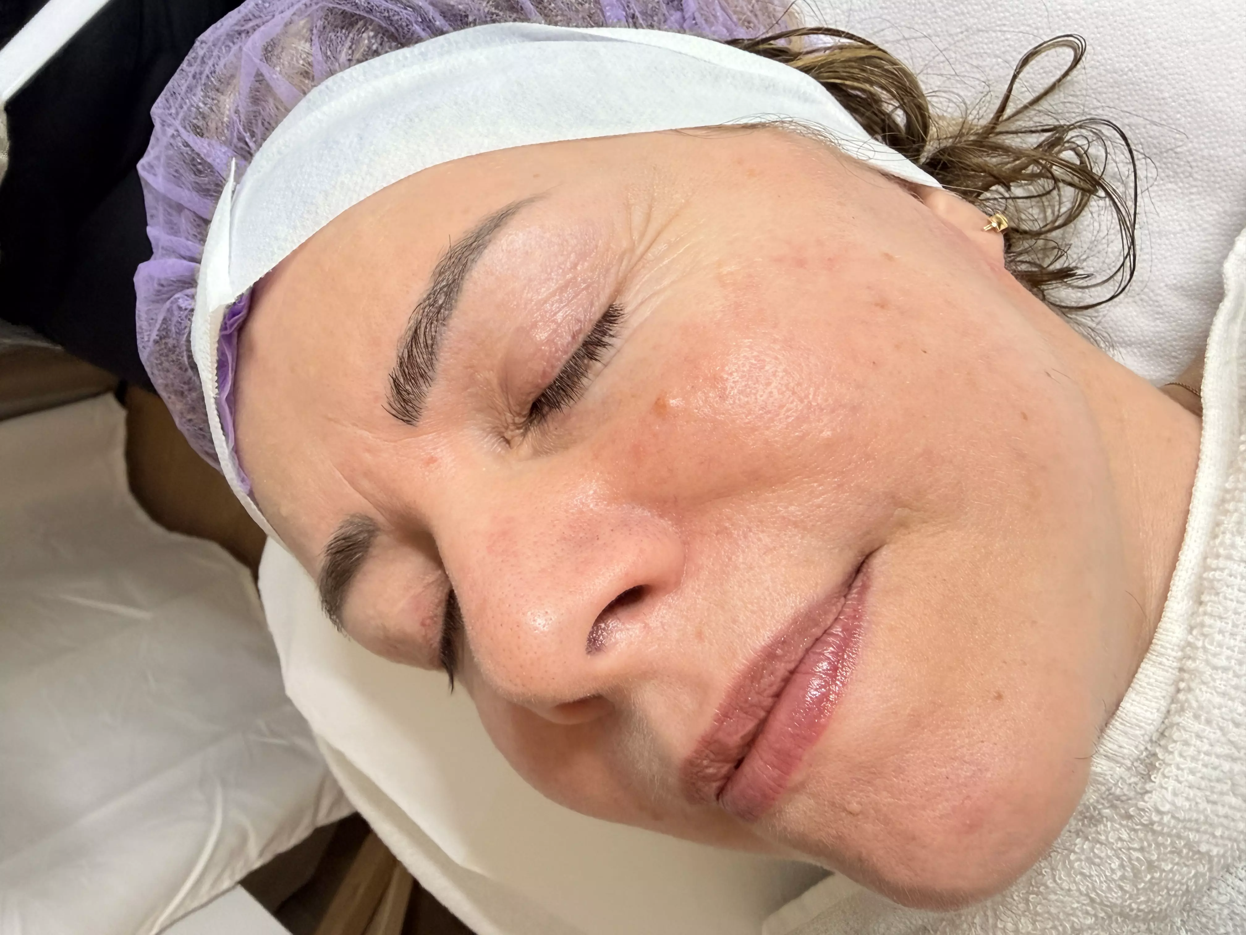 Soin du visage personnalisé