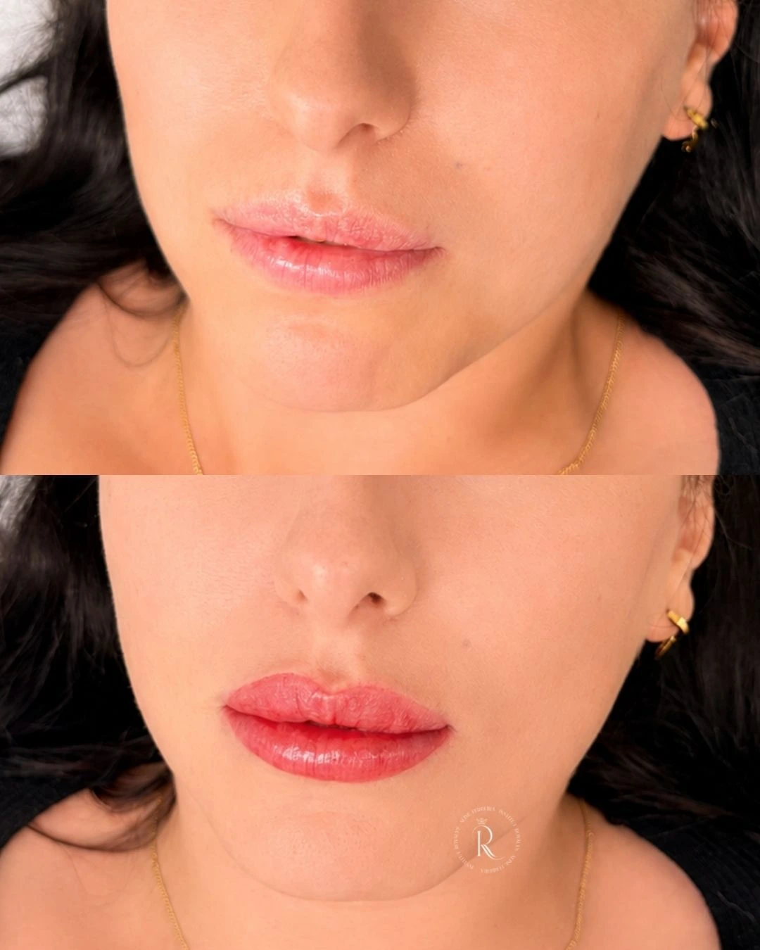 Micropigmentation labiale